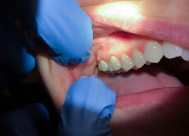 Best Urgent Tooth Repair  in Toppers, OK