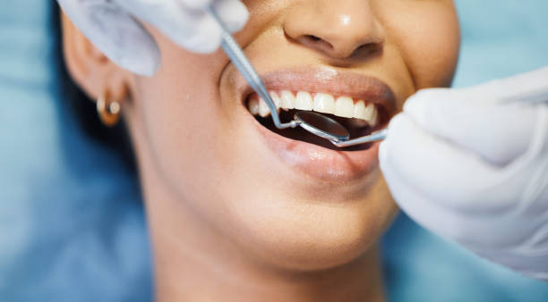 Best Tooth Pain Emergency Relief  in Toppers, OK