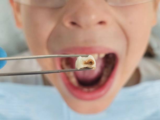 Best Urgent Dental Care  in Toppers, OK